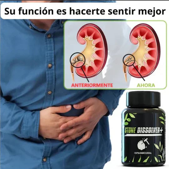 STONE DISSOLVER™ - Disuelve Cálculos, Alivia Dolor y Mejora el Flujo Urinario+envio gratis 2 por 1